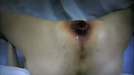 Larghezza della vide ...